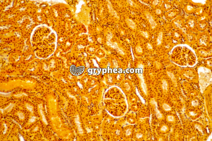 Glomérules Rein x40 - gryphea.com